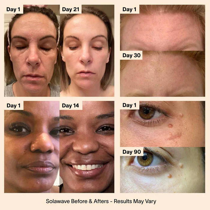 Advanced Skincare Wand with Red Light Therapy - Image 6