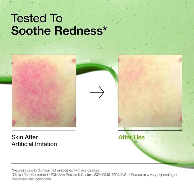 ANUA Azelaic Acid 10 Hyaluron Redness Soothing Serum - Image 3