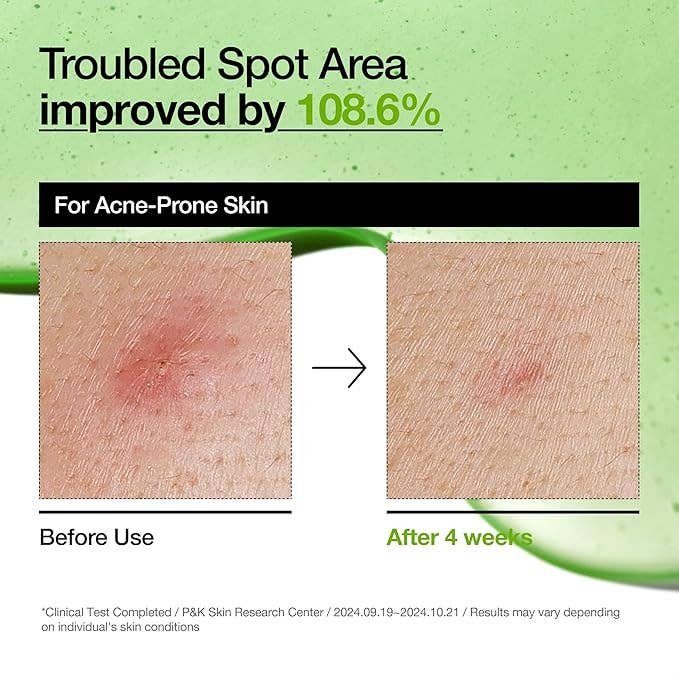 ANUA Azelaic Acid 10 Hyaluron Redness Soothing Serum - Image 4