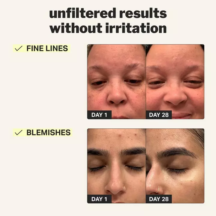 Beginner Retinol Gel 0.1% - Image 3