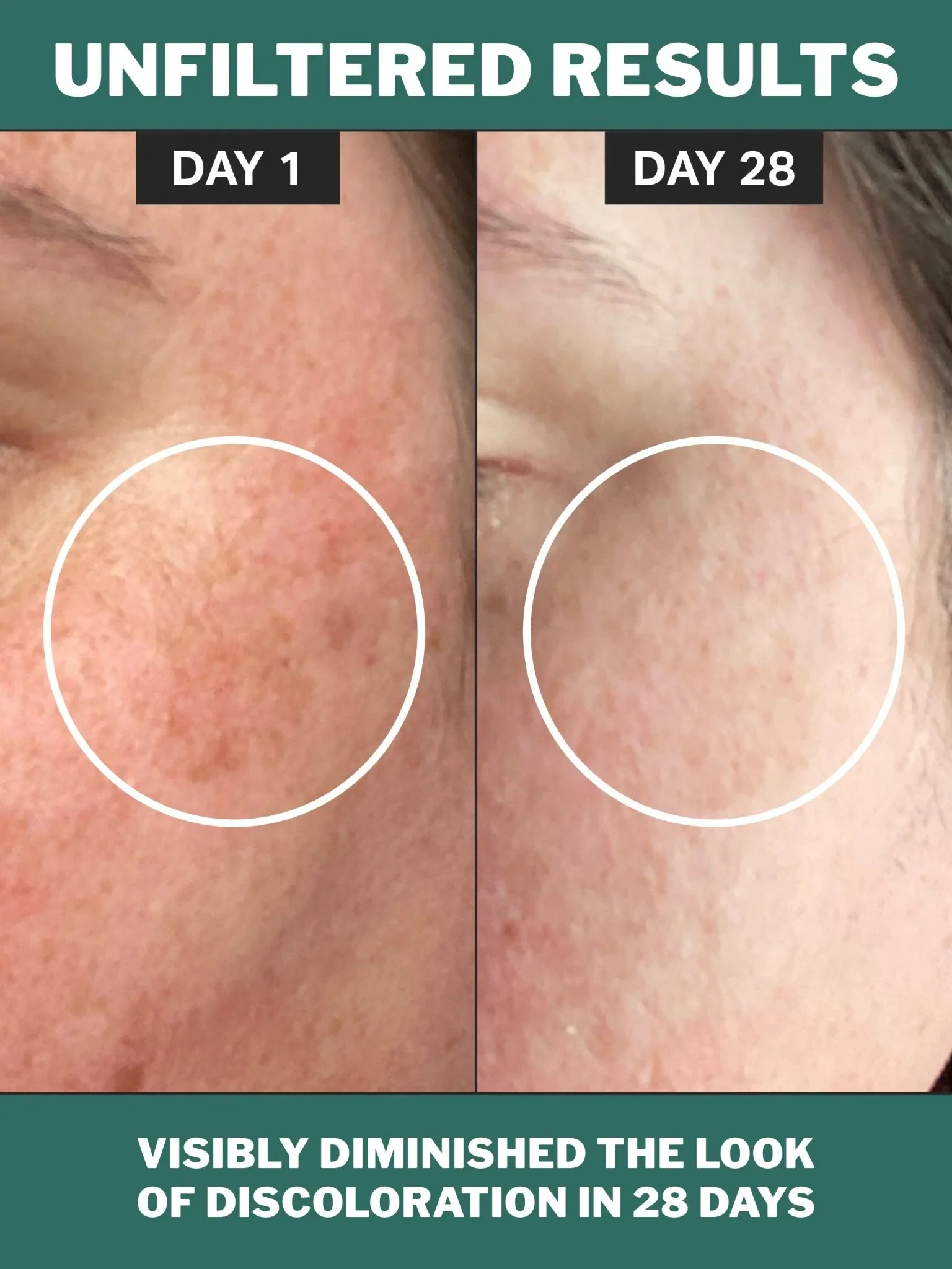 Chlorophyll Discoloration Serum with 1% Alpha Arbutin - Image 5