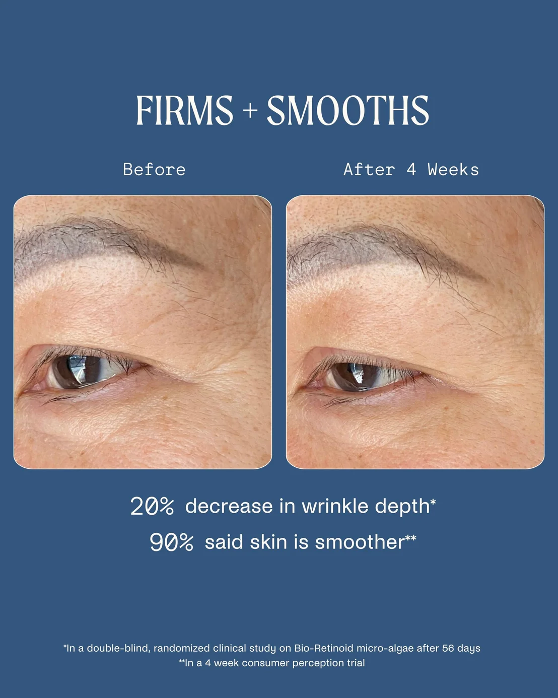 Dreamwave 2% Bio-Retinoid Complex Overnight Serum - Image 3