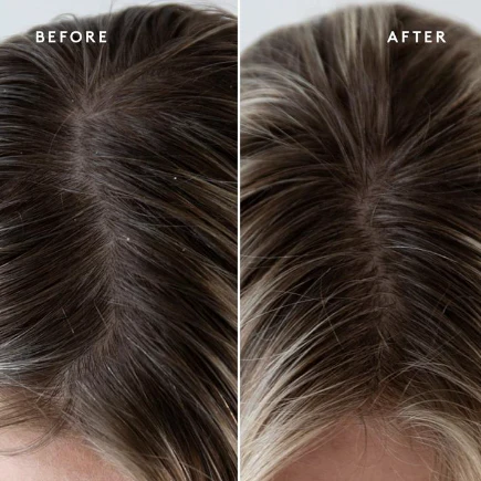 EXFOLIATING Scalp Treatment - Image 3