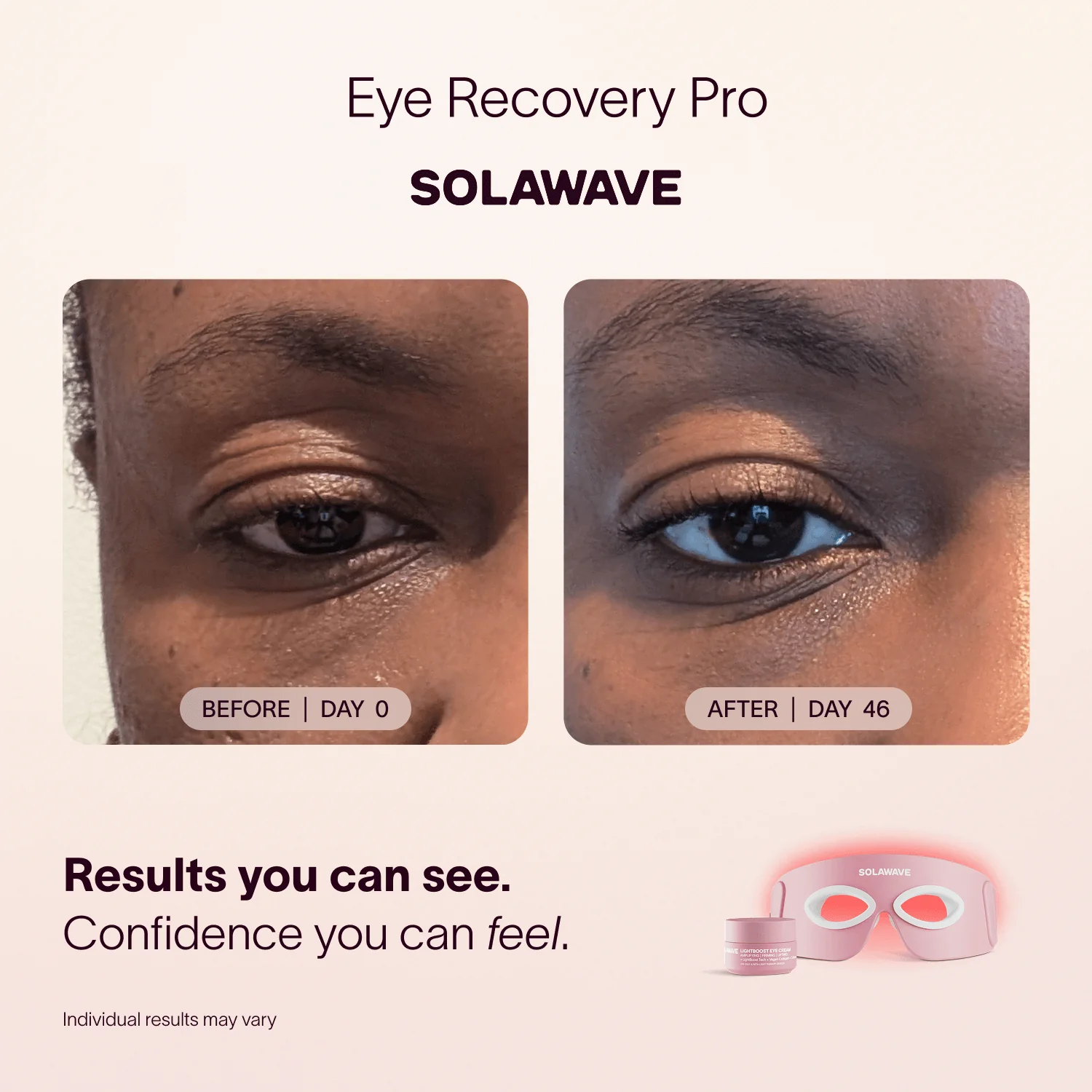 Eye Recovery Pro Kit - Image 3