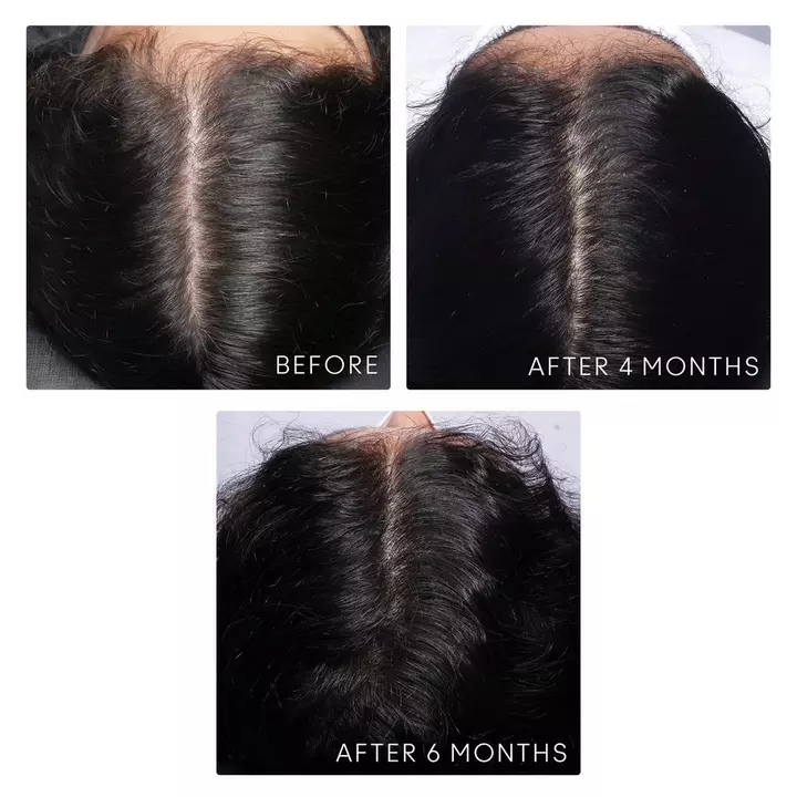FLOURISH Density Booster - For Thinning Hair - Image 3