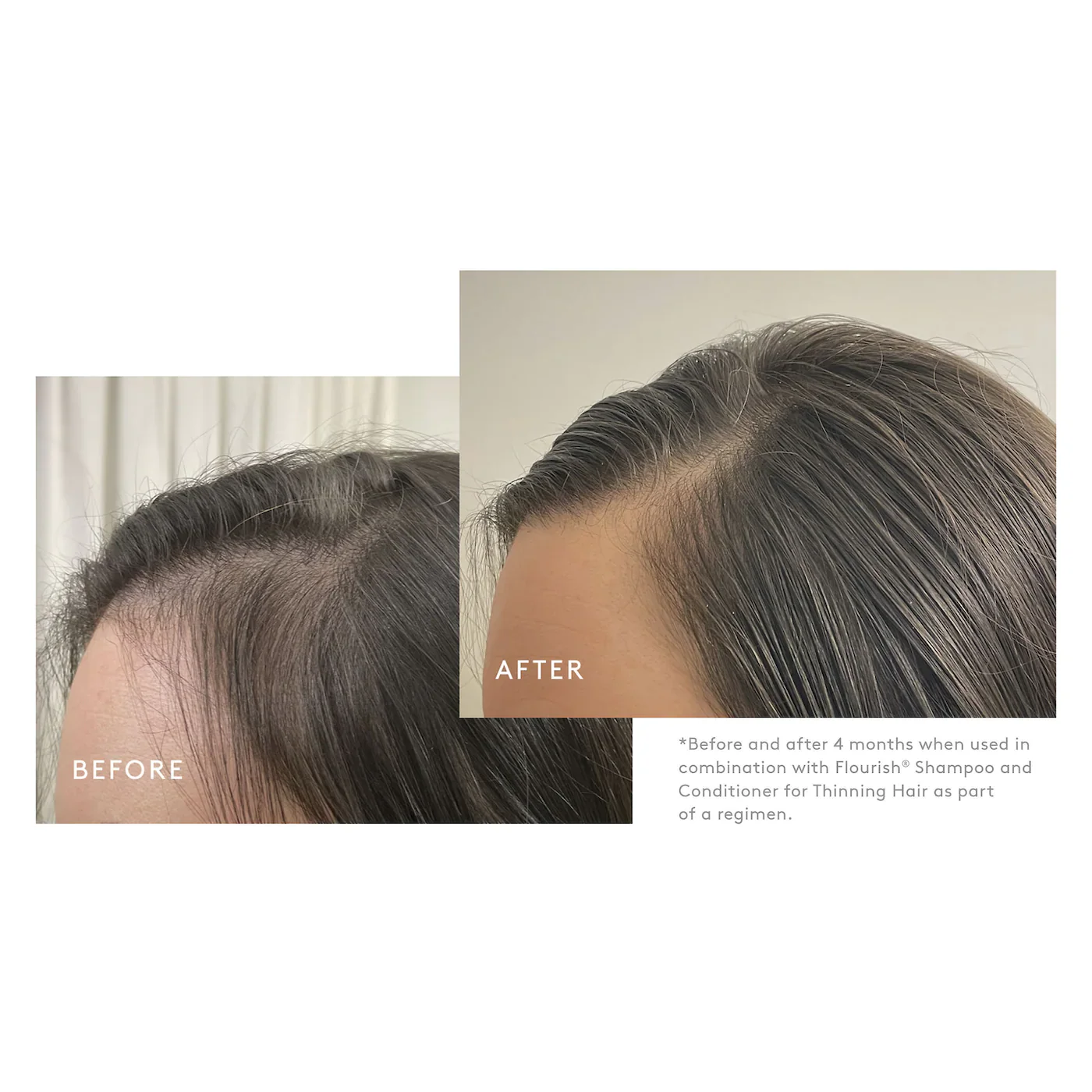 FLOURISH Density Booster - For Thinning Hair - Image 5