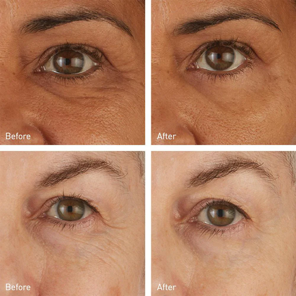 Hydro Cool Firming Eye Gels - Image 6