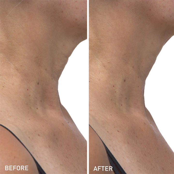 Hydro Cool Firming Neck Gels - Image 4