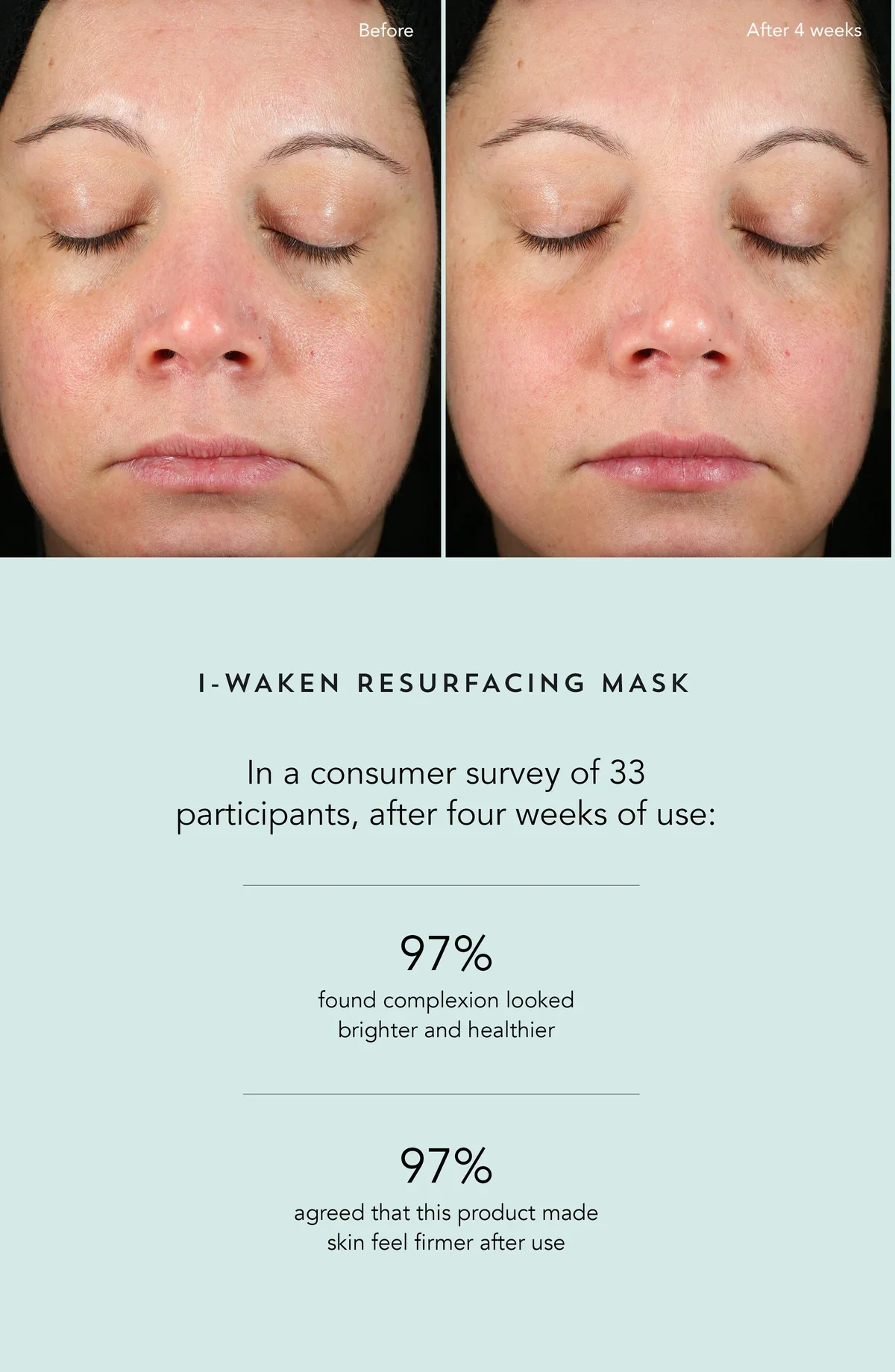 I-Waken Resurfacing Mask - Image 3