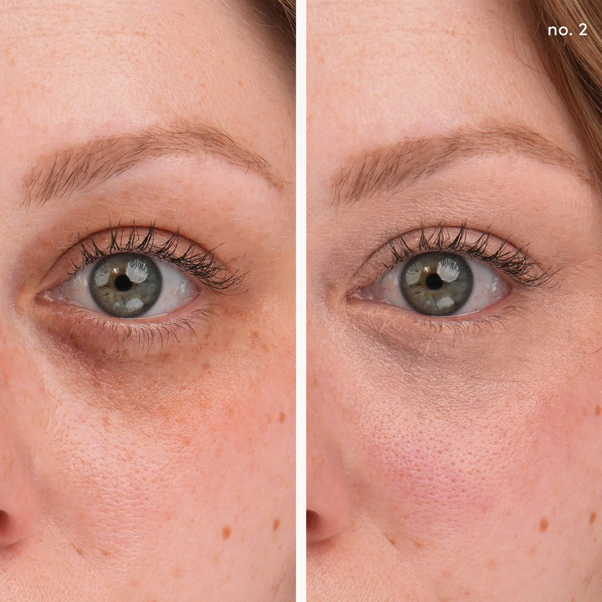 Circle\Delete® Concealer - Image 7