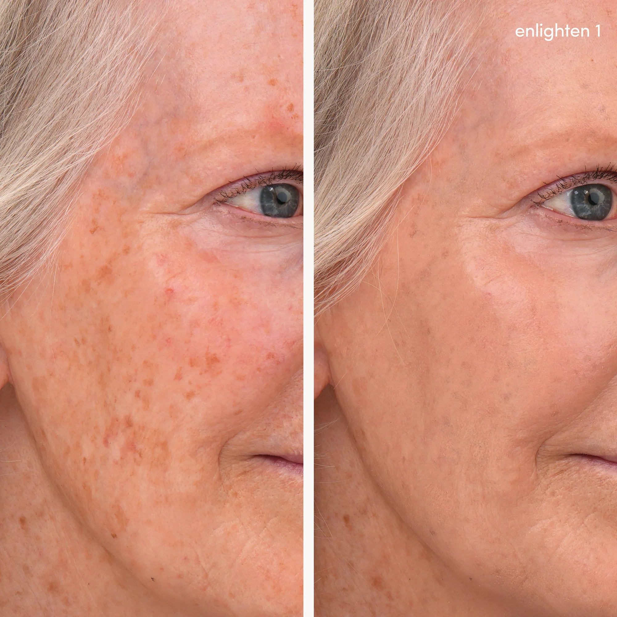 Enlighten Concealer™ - Image 2