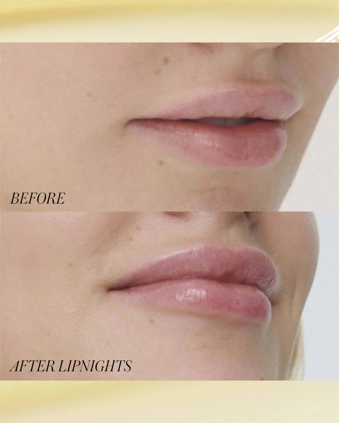 Lipnights Overnight Lip Mask - Image 3