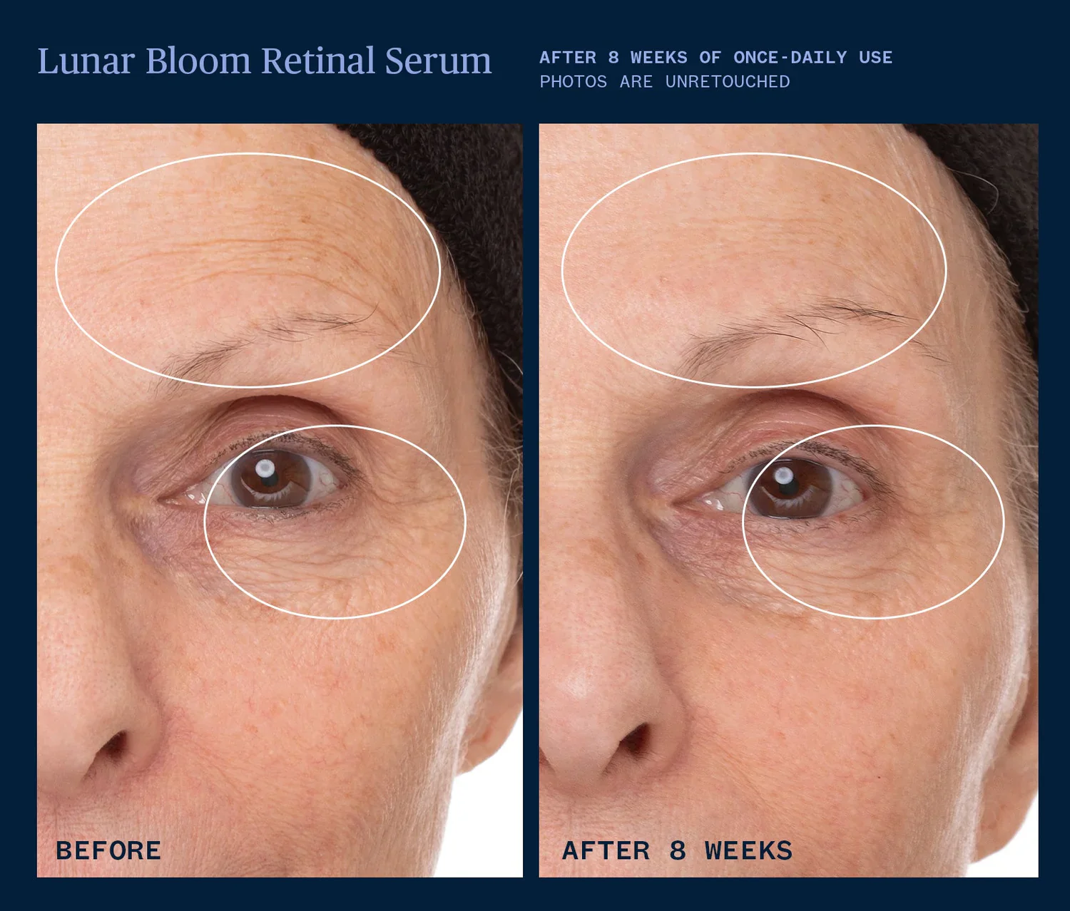 Lunar Bloom Retinal Serum - Image 4