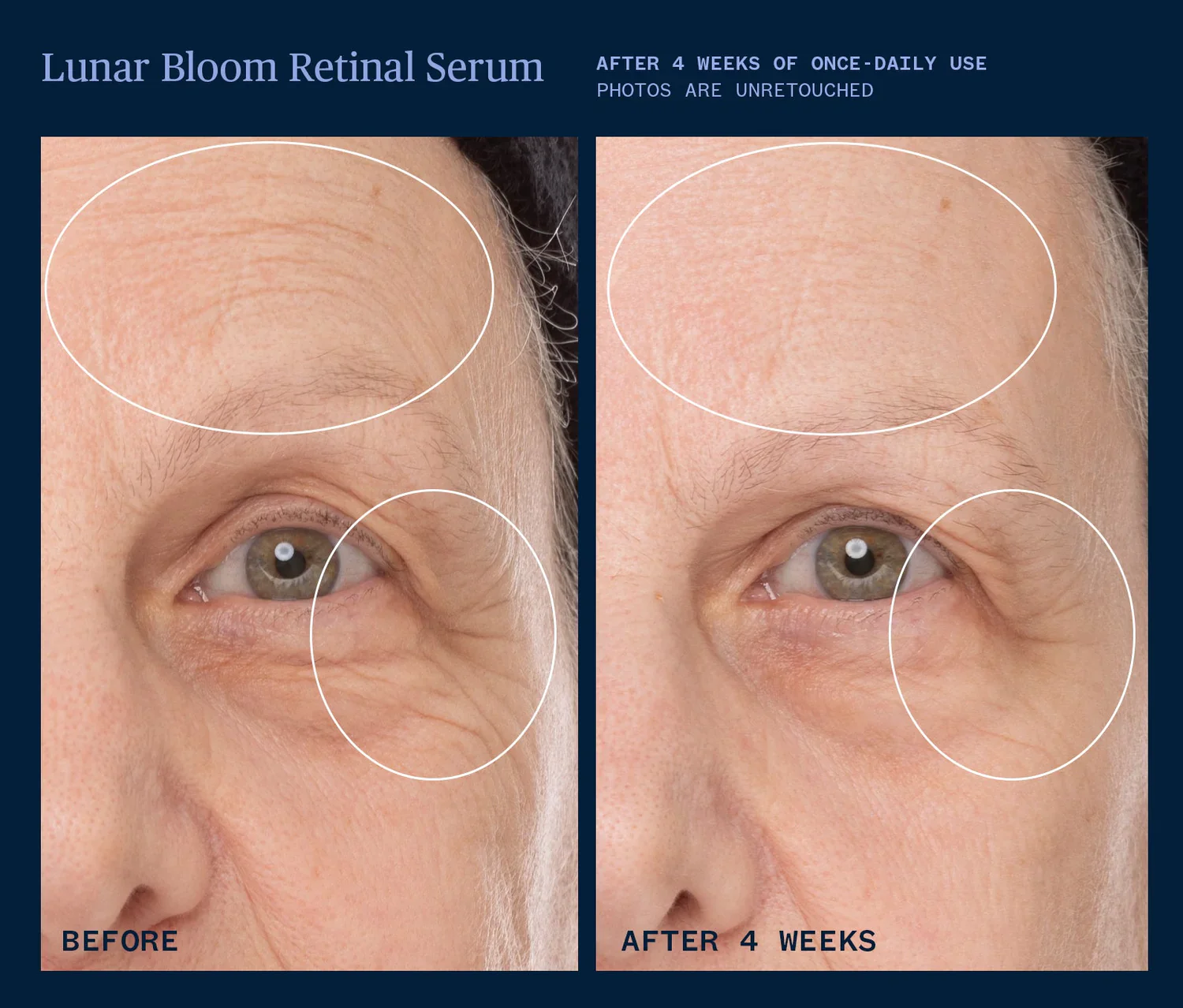 Lunar Bloom Retinal Serum - Image 5