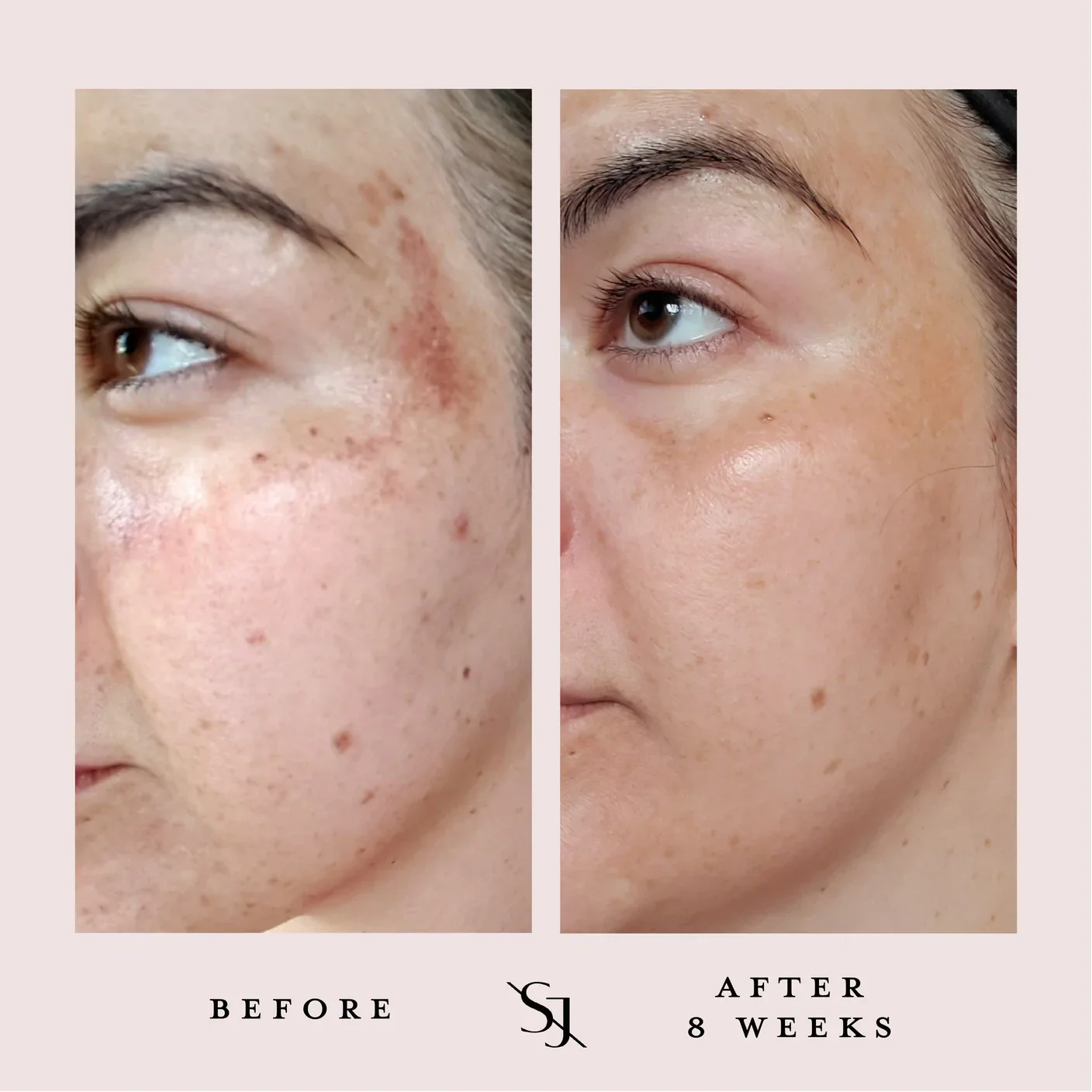 Luxury Beauty Serum Powerful Calming Treatment - Image 4