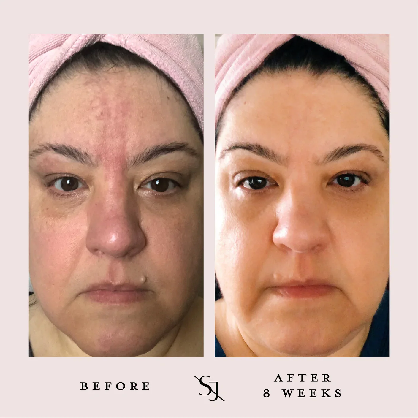 Luxury Beauty Serum Powerful Calming Treatment - Image 5
