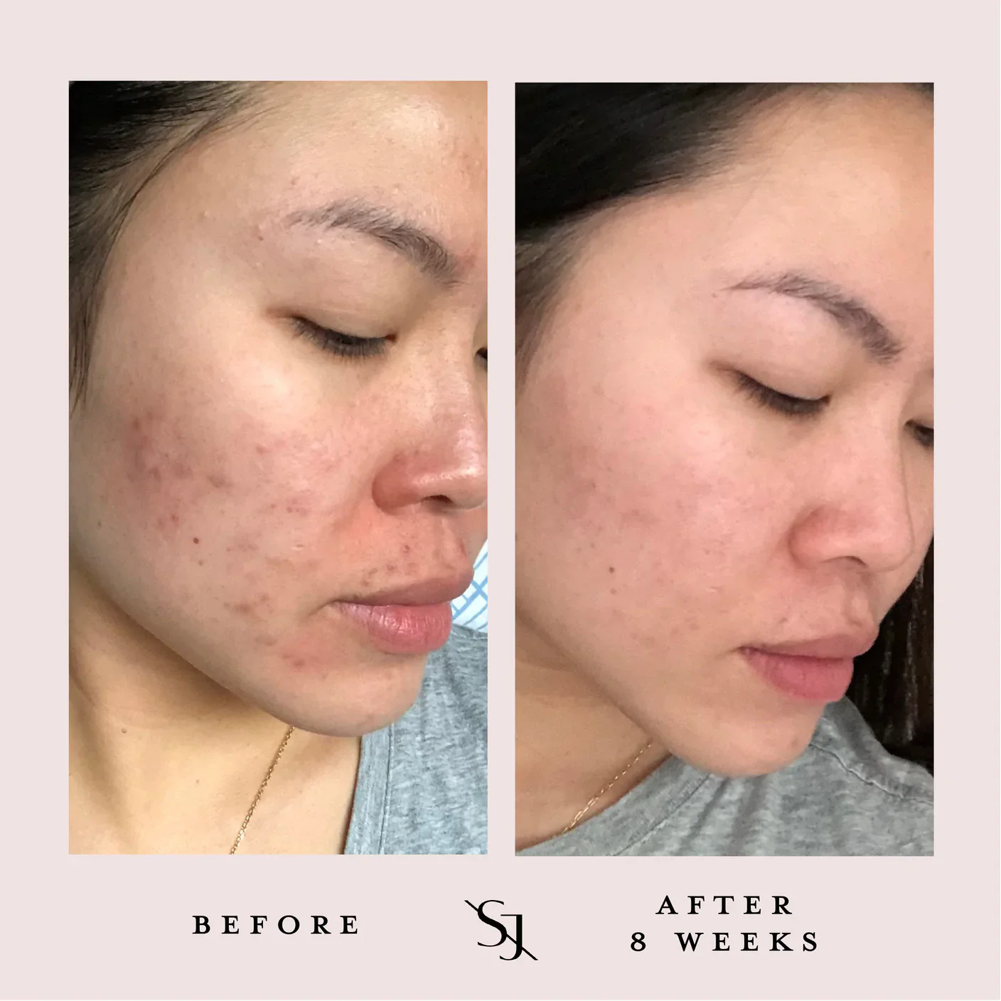 Luxury Beauty Serum Powerful Calming Treatment - Image 6