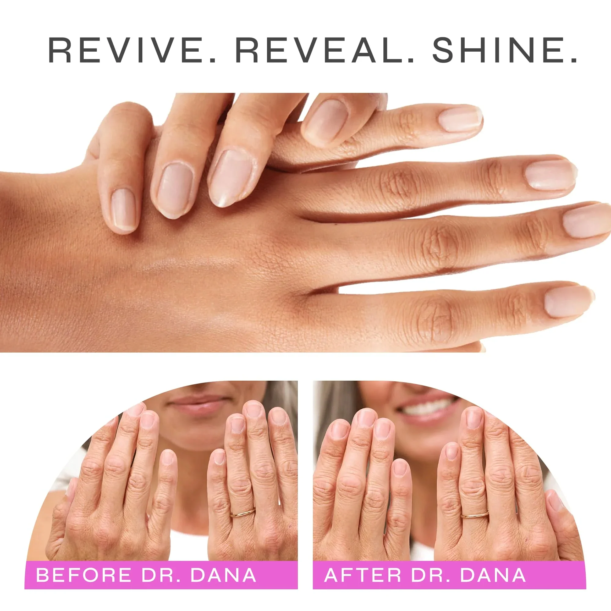 Nail Renewal System - Image 2