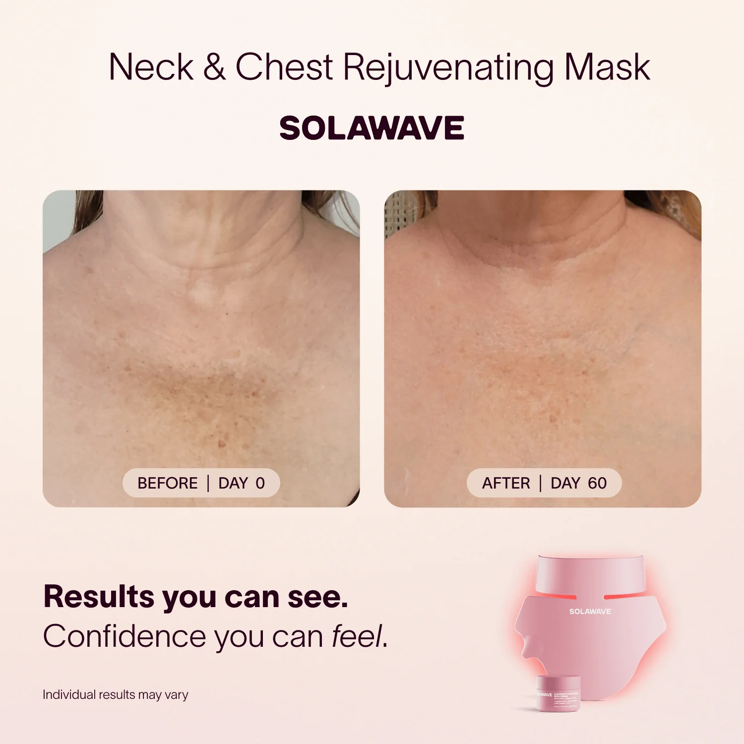 Neck & Chest LED Mask w/ LightBoost Cream Kit - Image 3
