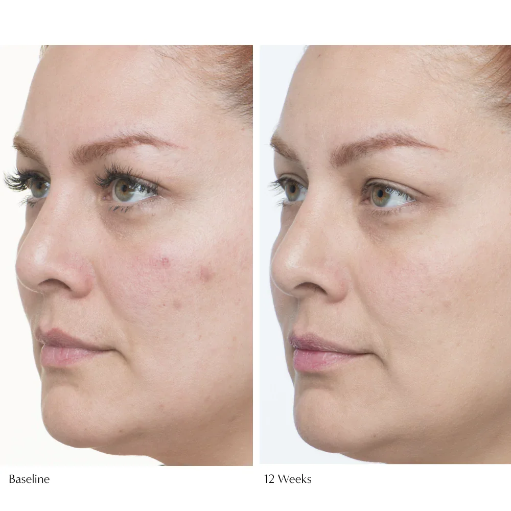 Plumscreen Broad Spectrum SPF 31 UVA/UVB/HEV PA+++ - Image 7