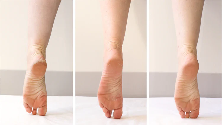 POSHPEEL™ PEDI CURE Exfoliating Foot Peel - Image 2