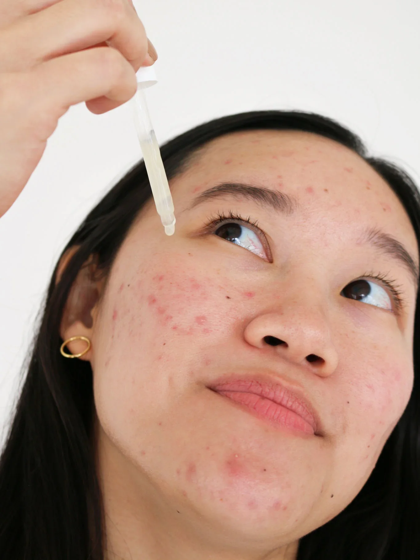 Postbiotic Acne Serum with 1.5% Salicylic Acid - Image 4