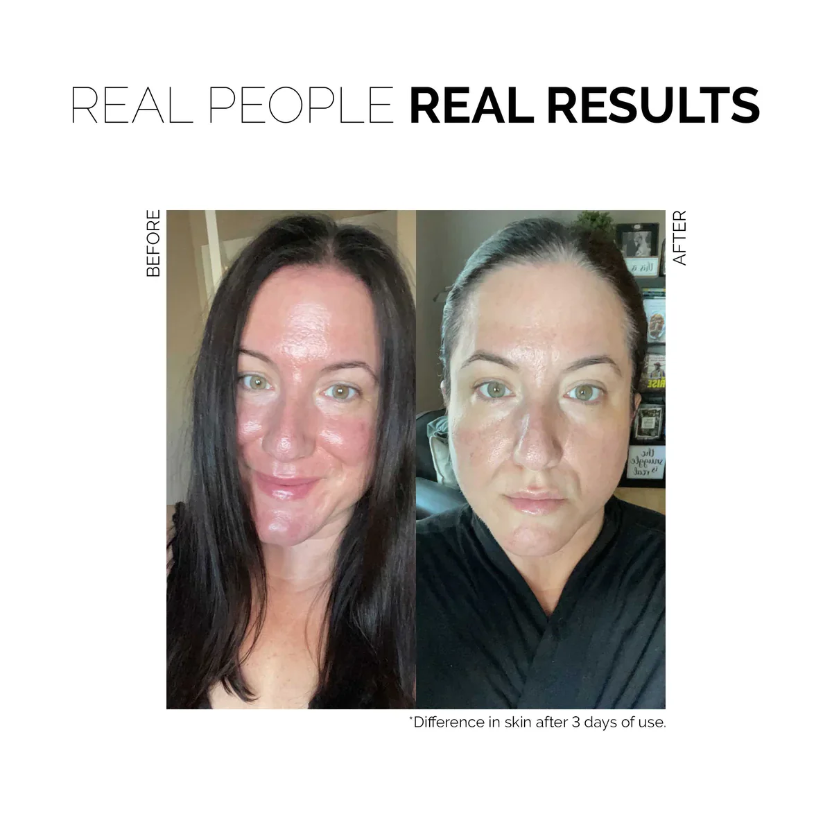 Redness Rescue Cream - Image 6