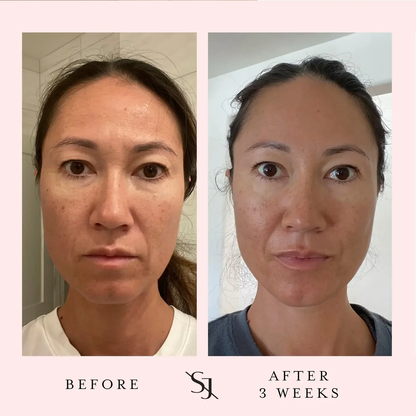 Sacred Sleep Overnight Repair with Retinol - Image 5