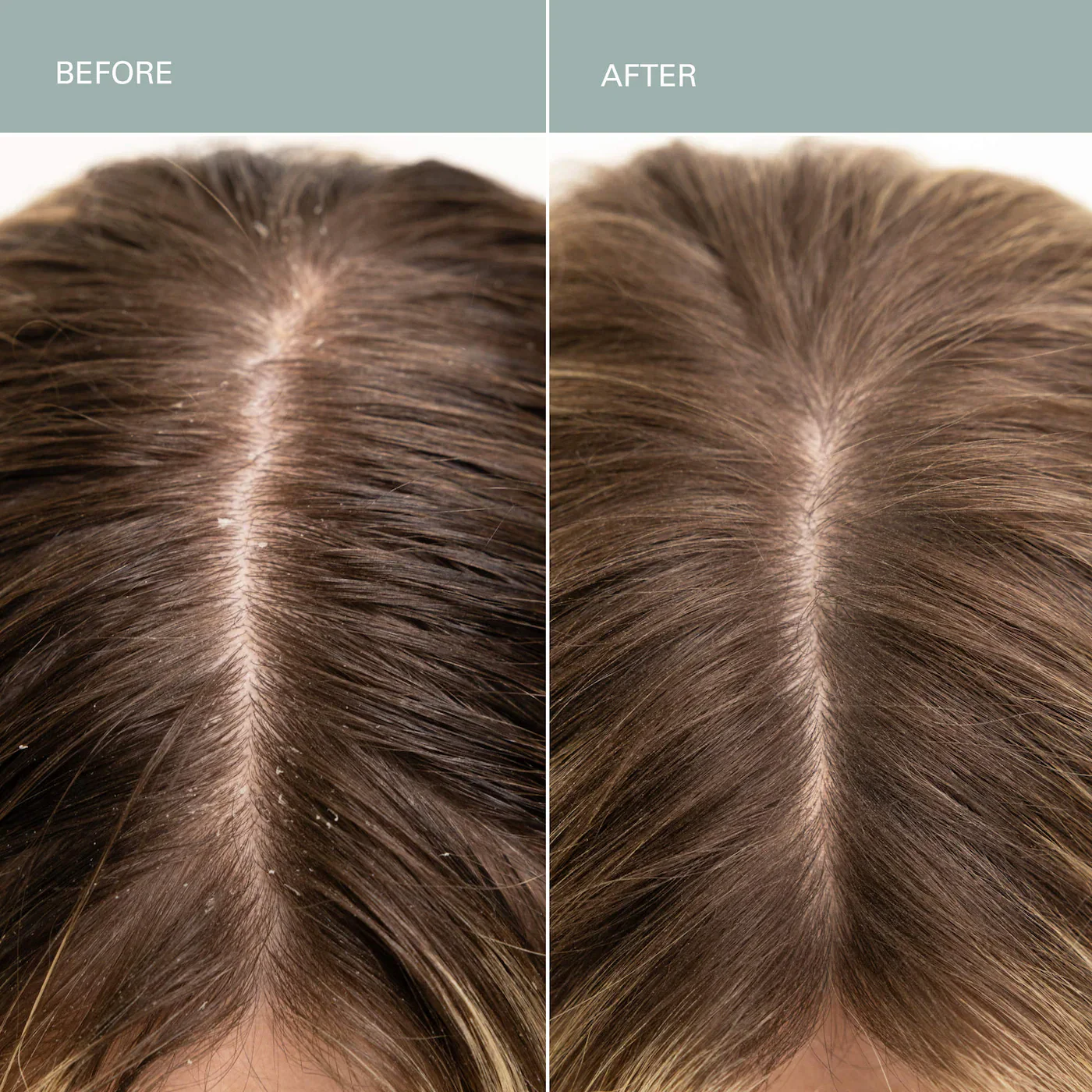 Salt Scalp Scrub Exfoliating Shampoo - Image 4