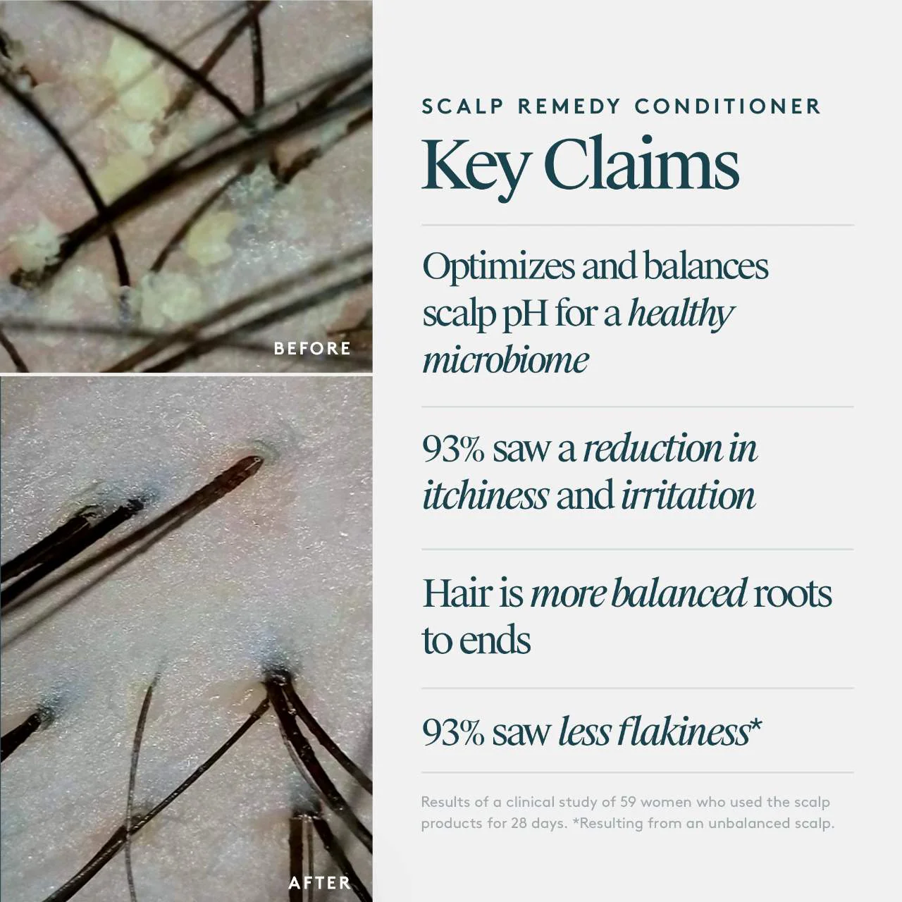 Scalp Remedy Conditioner - Image 6