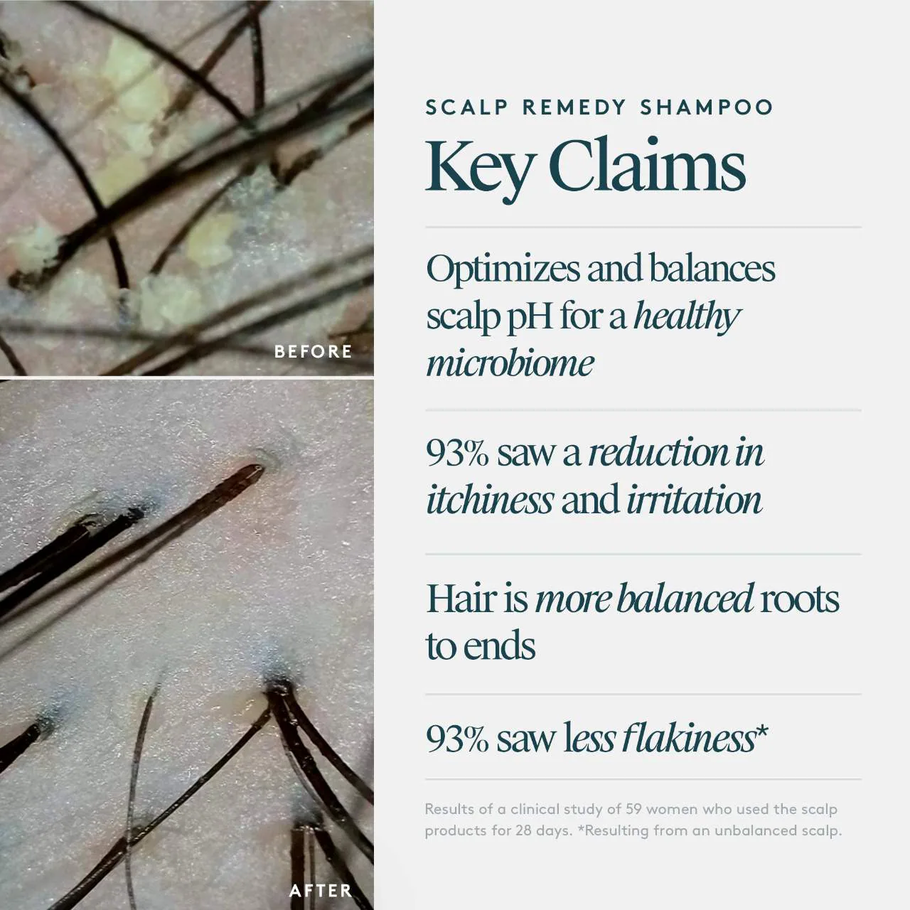 Scalp Remedy Shampoo - Image 6