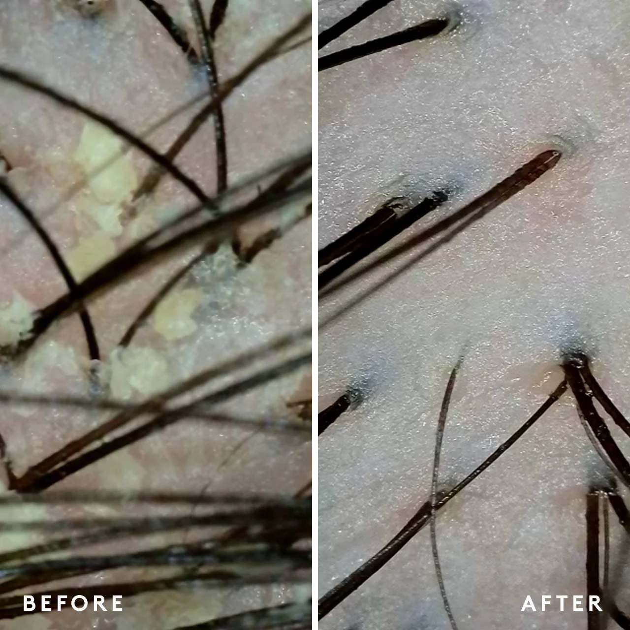Scalp Remedy Shampoo - Image 8