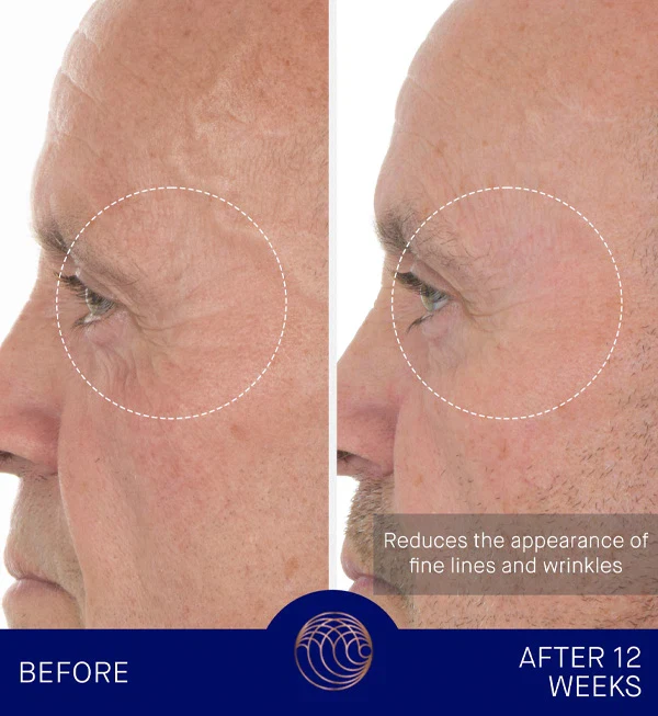The Retinol Serum - Image 4