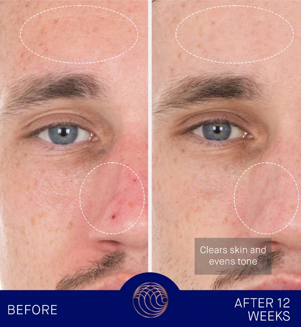 The Retinol Serum - Image 5
