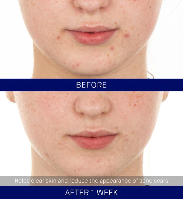 The Retinol Serum - Image 6