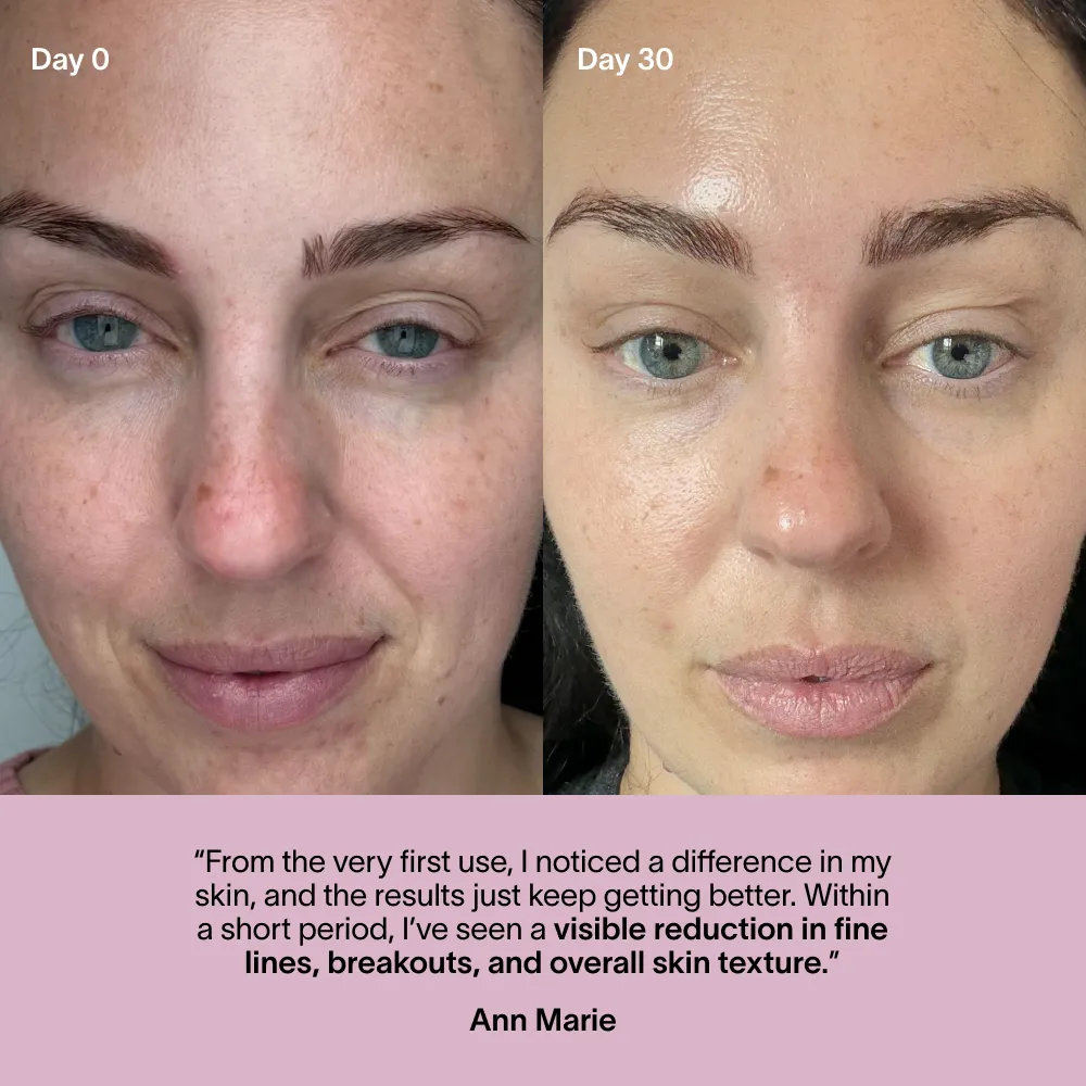 Wrinkle Retreat Face Mask & LightBoost Serum Kit - Image 11