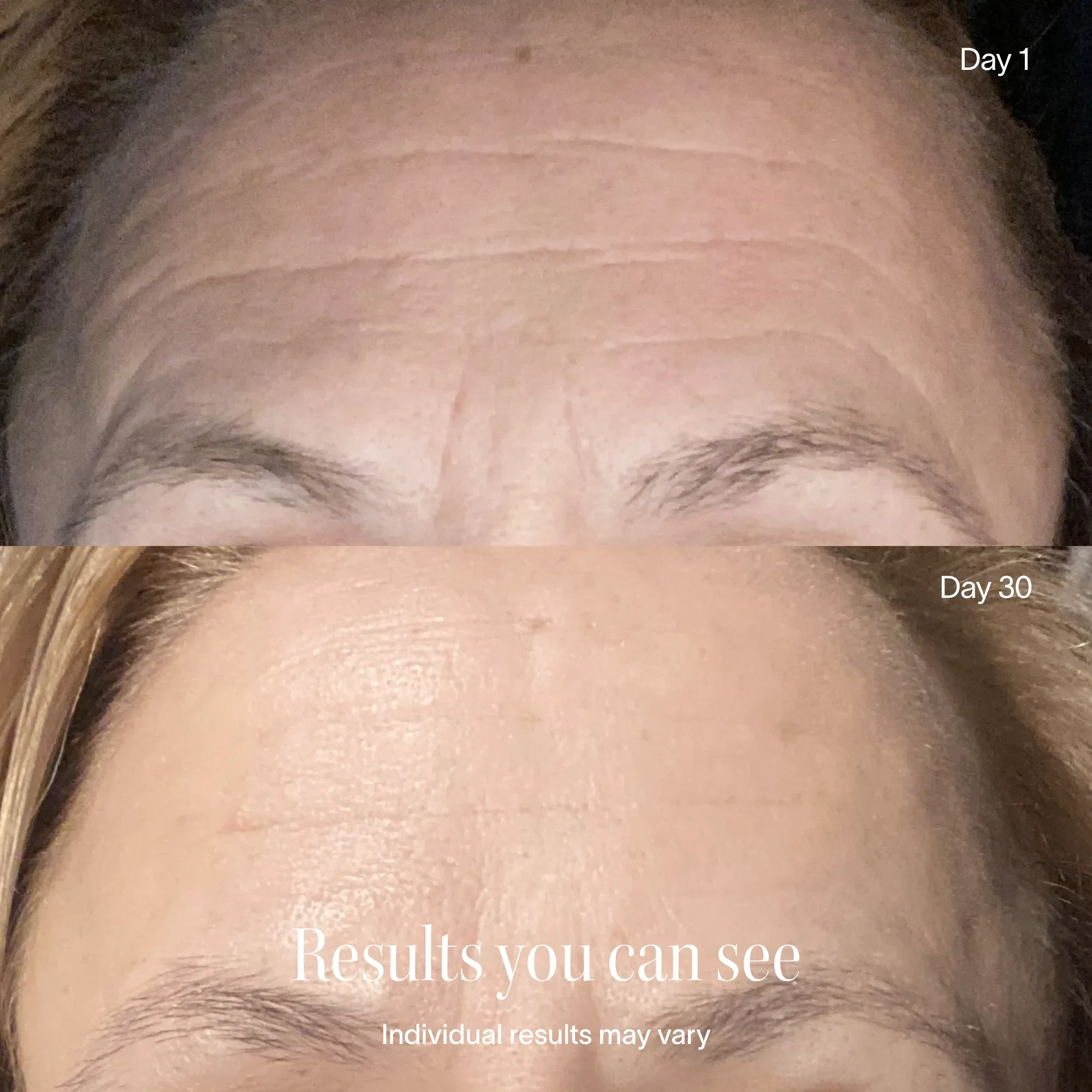 Wrinkle Retreat Face Mask & LightBoost Serum Kit - Image 8